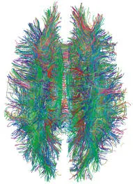 A colourful tractography image of the human brain seen from above, showing dense bundles of neural fibres in green, blue, red and purple.